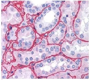 Immunohistochemistry (Formalin/PFA-fixed paraffin-embedded sections) - Anti-Collagen IV antibody (AB6586)