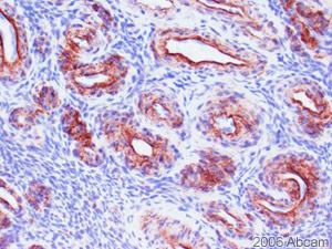 Immunohistochemistry (Formalin/PFA-fixed paraffin-embedded sections) - Anti-Collagen IV antibody [COL-94] (AB6311)