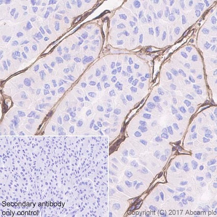 Immunohistochemistry (Formalin/PFA-fixed paraffin-embedded sections) - Anti-Collagen IV antibody [EPR20966] (AB214417), expandable thumbnail