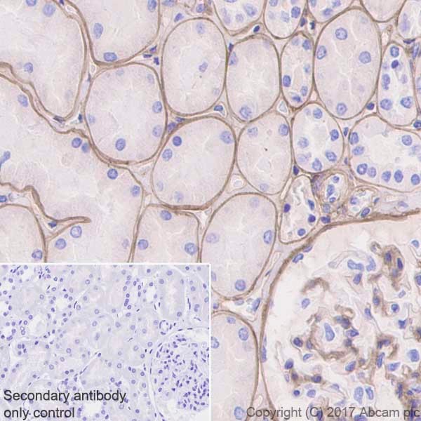 Immunohistochemistry (Formalin/PFA-fixed paraffin-embedded sections) - Anti-Collagen IV antibody [EPR20966] (AB214417), expandable thumbnail