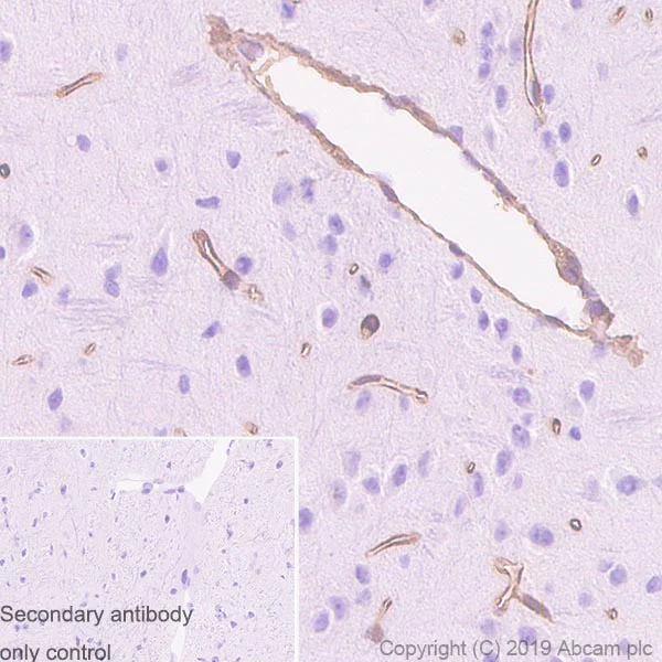 Immunohistochemistry (Formalin/PFA-fixed paraffin-embedded sections) - Anti-Collagen IV antibody [EPR22911-127] (AB236640)