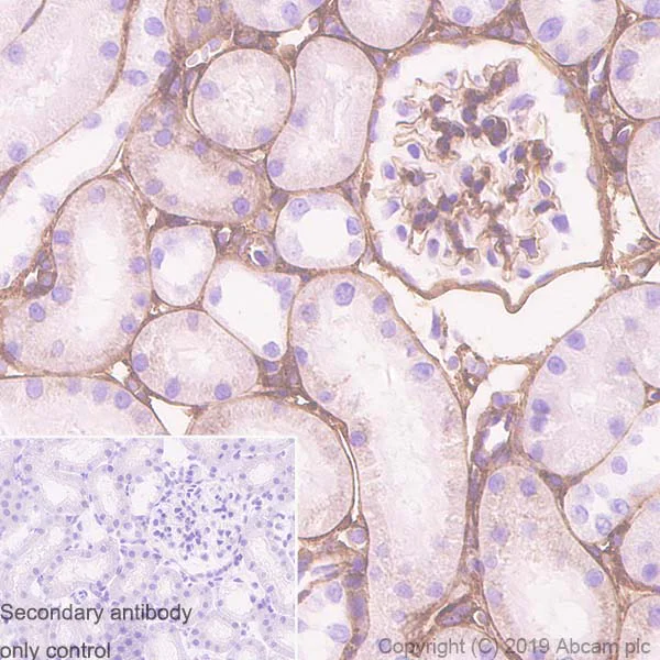 Immunohistochemistry (Formalin/PFA-fixed paraffin-embedded sections) - Anti-Collagen IV antibody [EPR22911-127] (AB236640)