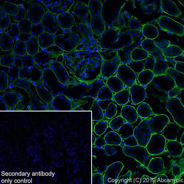 Immunohistochemistry (Frozen sections) - Anti-Collagen IV antibody [EPR22911-127] (AB236640)