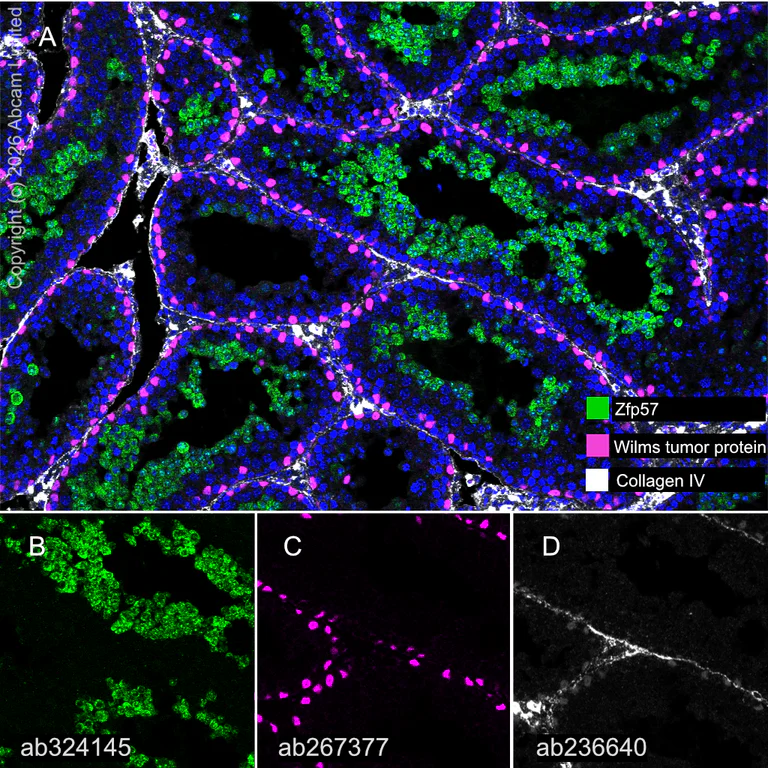 Multiplex immunohistochemistry - Anti-Collagen IV antibody [EPR22911-127] (AB236640)