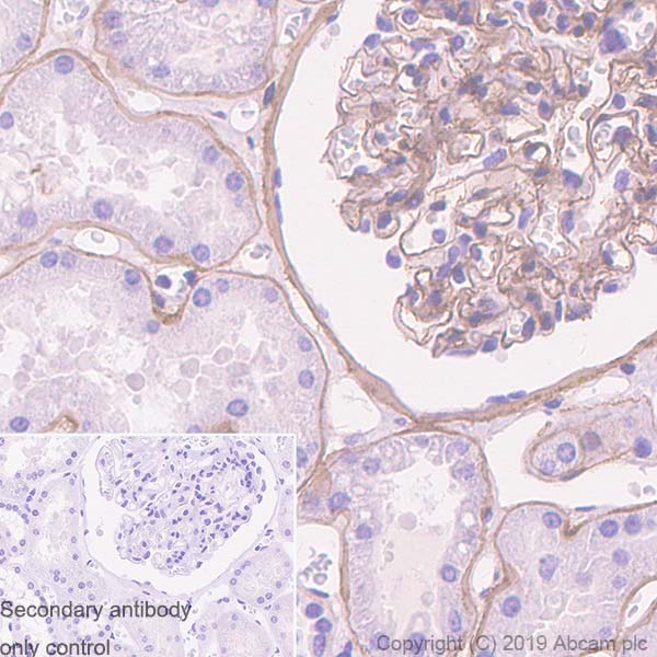 Immunohistochemistry (Formalin/PFA-fixed paraffin-embedded sections) - Anti-Collagen IV antibody [EPR22911-127] - BSA and Azide free (AB256353)