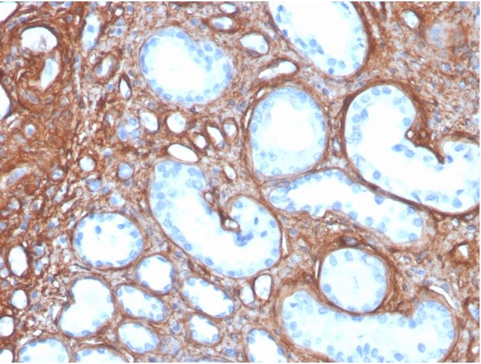 Immunohistochemistry (Formalin/PFA-fixed paraffin-embedded sections) - Anti-Collagen IV antibody [rCOL4/4742] (AB273607), expandable thumbnail
