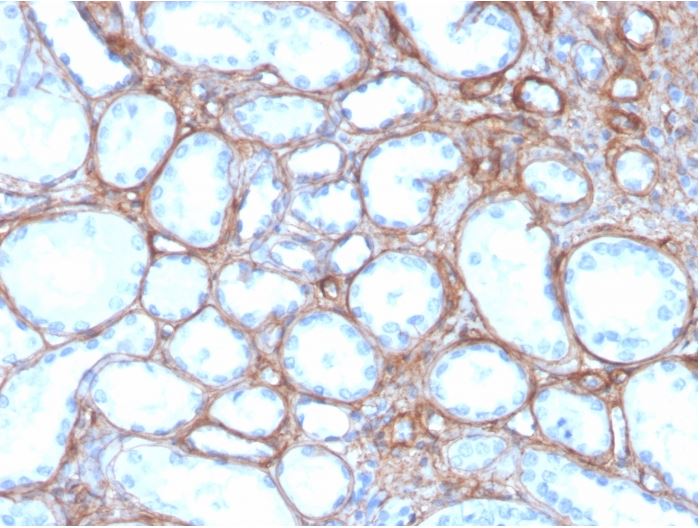 Immunohistochemistry (Formalin/PFA-fixed paraffin-embedded sections) - Anti-Collagen IV antibody [rCOL4/4742] (AB273607), expandable thumbnail