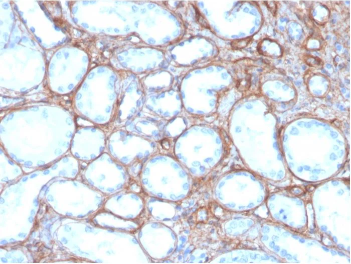 Immunohistochemistry (Formalin/PFA-fixed paraffin-embedded sections) - Anti-Collagen IV antibody [rCOL4/4742] (AB273607)