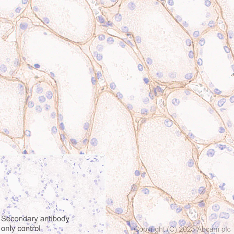 Immunohistochemistry (Formalin/PFA-fixed paraffin-embedded sections) - Anti-Collagen IV antibody [RM1065] - BSA and Azide free (AB315251)