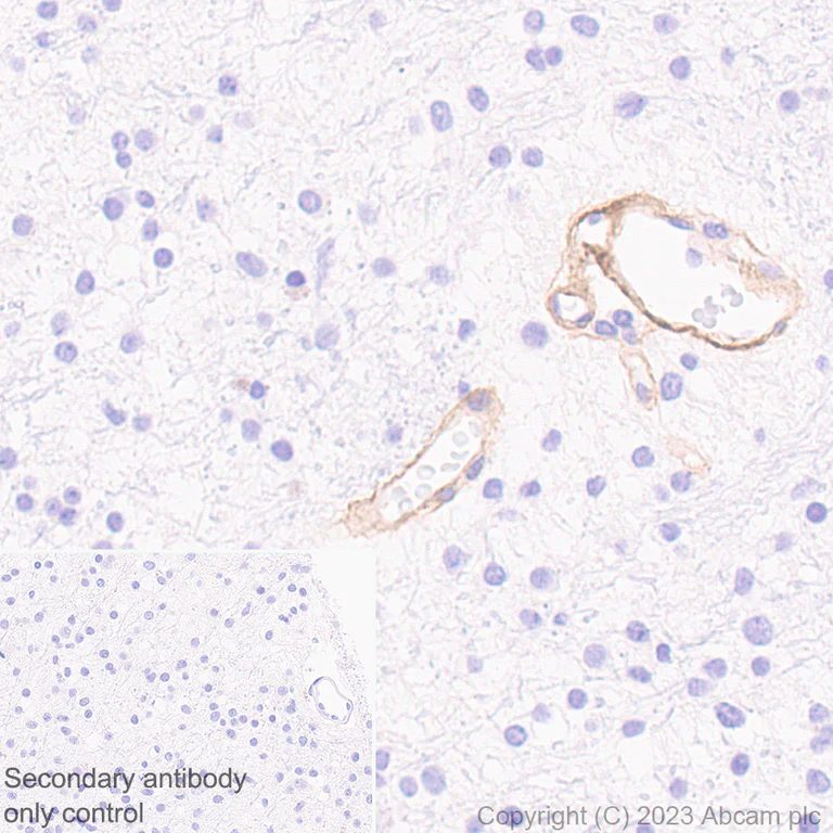 Immunohistochemistry (Formalin/PFA-fixed paraffin-embedded sections) - Anti-Collagen IV antibody [RM1065] - BSA and Azide free (AB315251)