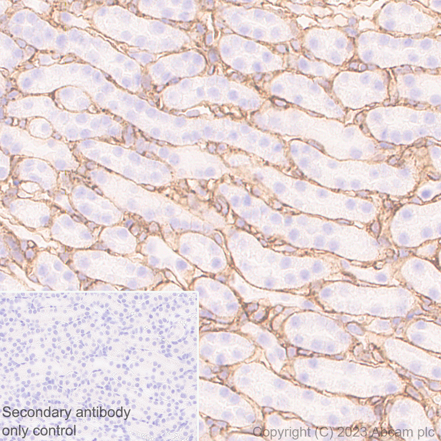 Immunohistochemistry (Formalin/PFA-fixed paraffin-embedded sections) - Anti-Collagen IV antibody [RM1065] - BSA and Azide free (AB315251), expandable thumbnail
