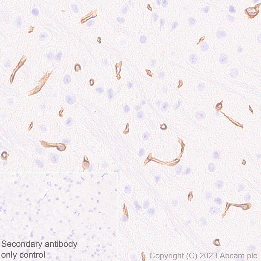 Immunohistochemistry (Formalin/PFA-fixed paraffin-embedded sections) - Anti-Collagen IV antibody [RM1065] - BSA and Azide free (AB315251), expandable thumbnail
