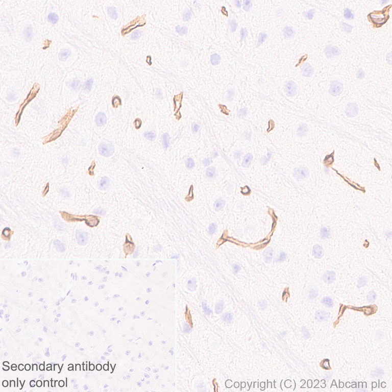 Immunohistochemistry (Formalin/PFA-fixed paraffin-embedded sections) - Anti-Collagen IV antibody [RM1065] - BSA and Azide free (AB315251)