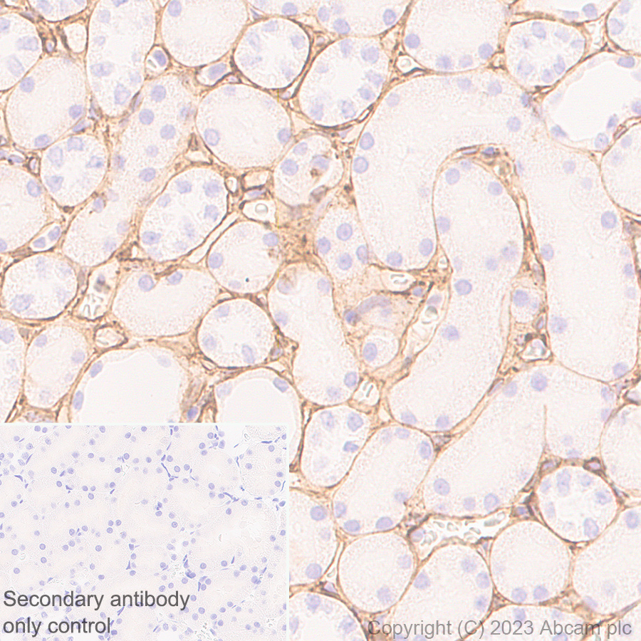 Immunohistochemistry (Formalin/PFA-fixed paraffin-embedded sections) - Anti-Collagen IV antibody [RM1065] - BSA and Azide free (AB315251), expandable thumbnail