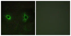 Immunocytochemistry/ Immunofluorescence - Anti-Collagen Type IV alpha 3 (COL4a3) antibody (AB111742)