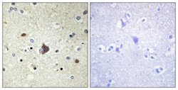 Immunohistochemistry (Formalin/PFA-fixed paraffin-embedded sections) - Anti-Collagen Type IV alpha 3 (COL4a3) antibody (AB111742)
