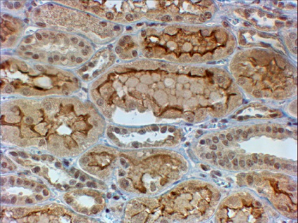 Immunohistochemistry (Formalin/PFA-fixed paraffin-embedded sections) - Anti-Collagen Type IV alpha 3 (COL4a3) antibody (AB223227)