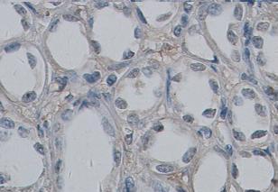 Immunohistochemistry (Formalin/PFA-fixed paraffin-embedded sections) - Anti-Collagen Type IV alpha 3 (COL4a3) antibody (AB85103)