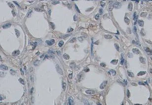 Immunohistochemistry (Formalin/PFA-fixed paraffin-embedded sections) - Anti-Collagen Type IV alpha 3 (COL4a3) antibody (AB85103)