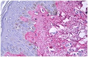 Immunohistochemistry (Formalin/PFA-fixed paraffin-embedded sections) - Anti-Collagen V antibody (AB134800), expandable thumbnail