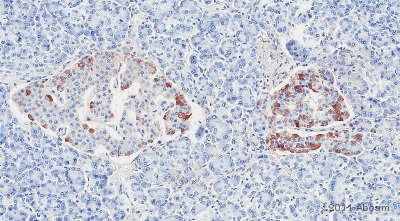 Immunohistochemistry (Formalin/PFA-fixed paraffin-embedded sections) - Anti-Collagen V antibody (AB7046)