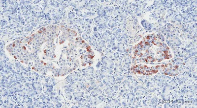 Immunohistochemistry (Formalin/PFA-fixed paraffin-embedded sections) - Anti-Collagen V antibody (AB7046)