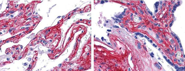 Immunohistochemistry (Formalin/PFA-fixed paraffin-embedded sections) - Anti-Collagen V antibody (AB7046)