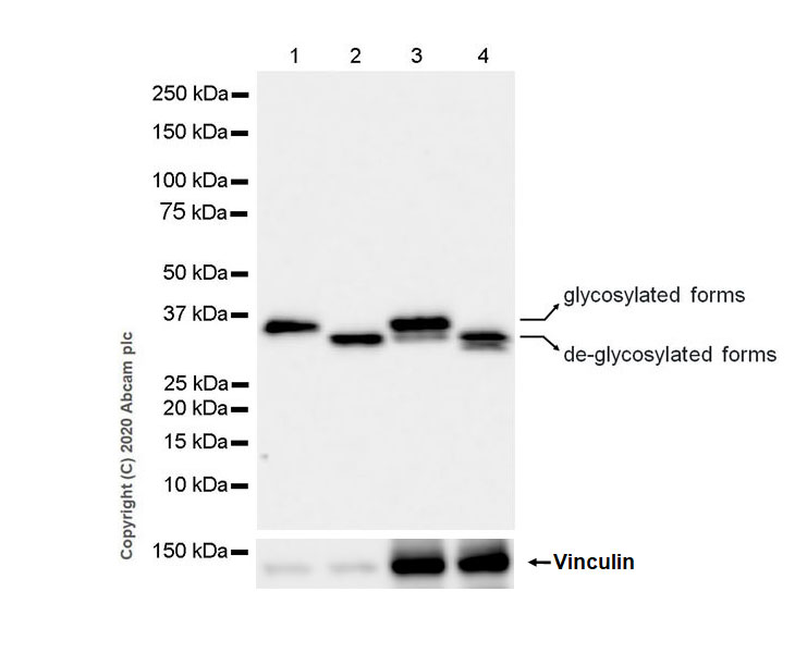 Western blot - Anti-Collagen V antibody [EPR23762-54] (AB275881), expandable thumbnail