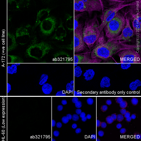 Immunocytochemistry/ Immunofluorescence - Anti-Collagen V antibody [EPR28737-61] (AB321795), expandable thumbnail