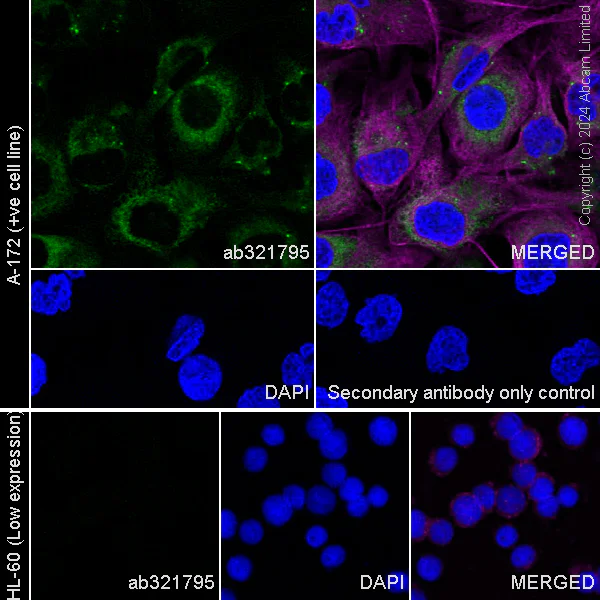Immunocytochemistry/ Immunofluorescence - Anti-Collagen V antibody [EPR28737-61] (AB321795)