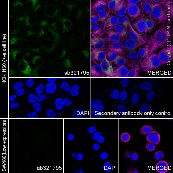 Immunocytochemistry/ Immunofluorescence - Anti-Collagen V antibody [EPR28737-61] - BSA and Azide free (AB321796)