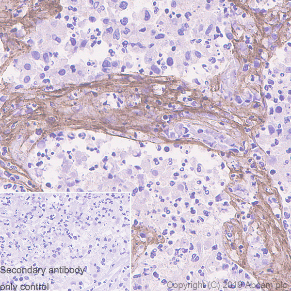 Immunohistochemistry (Formalin/PFA-fixed paraffin-embedded sections) - Anti-Collagen VI alpha 2 antibody [EPR7889(N)] (AB180855), expandable thumbnail