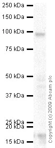 Western blot - Anti-Collagen VI antibody (AB6588)