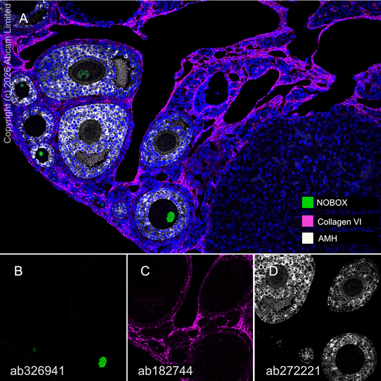 Multiplex immunohistochemistry - Anti-Collagen VI antibody [EPR17072] (AB182744)