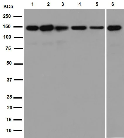 Western blot - Anti-Collagen VI antibody [EPR17072] (AB182744)