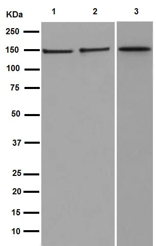 Western blot - Anti-Collagen VI antibody [EPR17072] (AB182744)