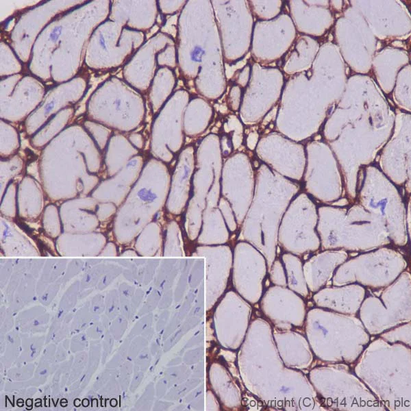 Immunohistochemistry (Formalin/PFA-fixed paraffin-embedded sections) - Anti-Collagen VI antibody [EPR17072] - BSA and Azide free (AB271938)