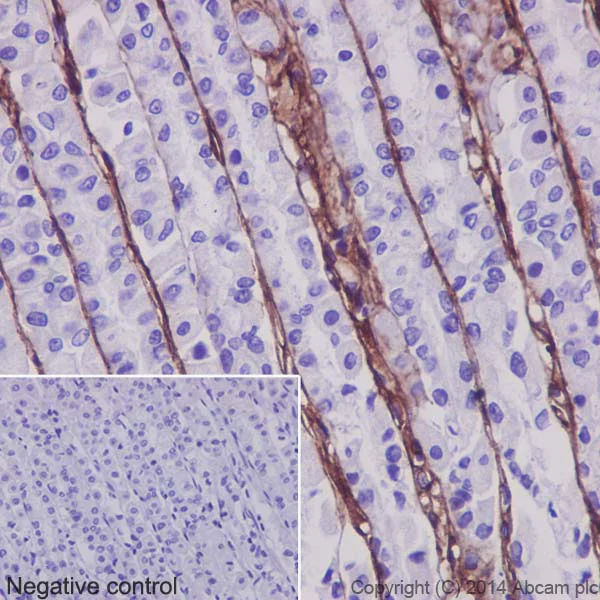 Immunohistochemistry (Formalin/PFA-fixed paraffin-embedded sections) - Anti-Collagen VI antibody [EPR17072] - BSA and Azide free (AB271938)