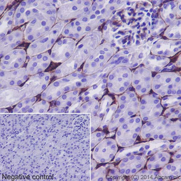 Immunohistochemistry (Formalin/PFA-fixed paraffin-embedded sections) - Anti-Collagen VI antibody [EPR17072] - BSA and Azide free (AB271938)