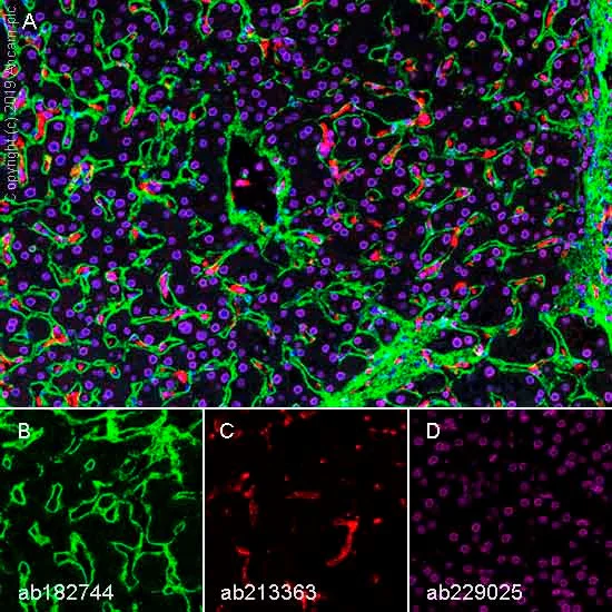 Multiplex immunohistochemistry - Anti-Collagen VI antibody [EPR17072] - BSA and Azide free (AB271938)