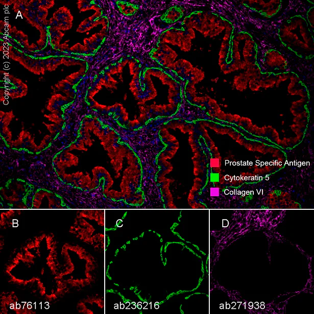 Multiplex immunohistochemistry - Anti-Collagen VI antibody [EPR17072] - BSA and Azide free (AB271938)