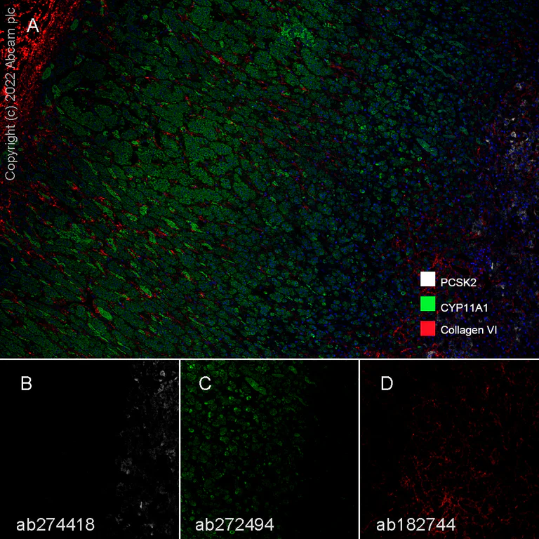 Multiplex immunohistochemistry - Anti-Collagen VI antibody [EPR17072] - BSA and Azide free (AB271938)