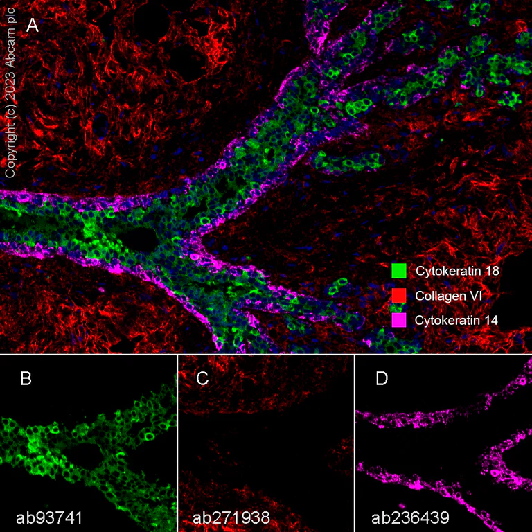 Multiplex immunohistochemistry - Anti-Collagen VI antibody [EPR17072] - BSA and Azide free (AB271938)
