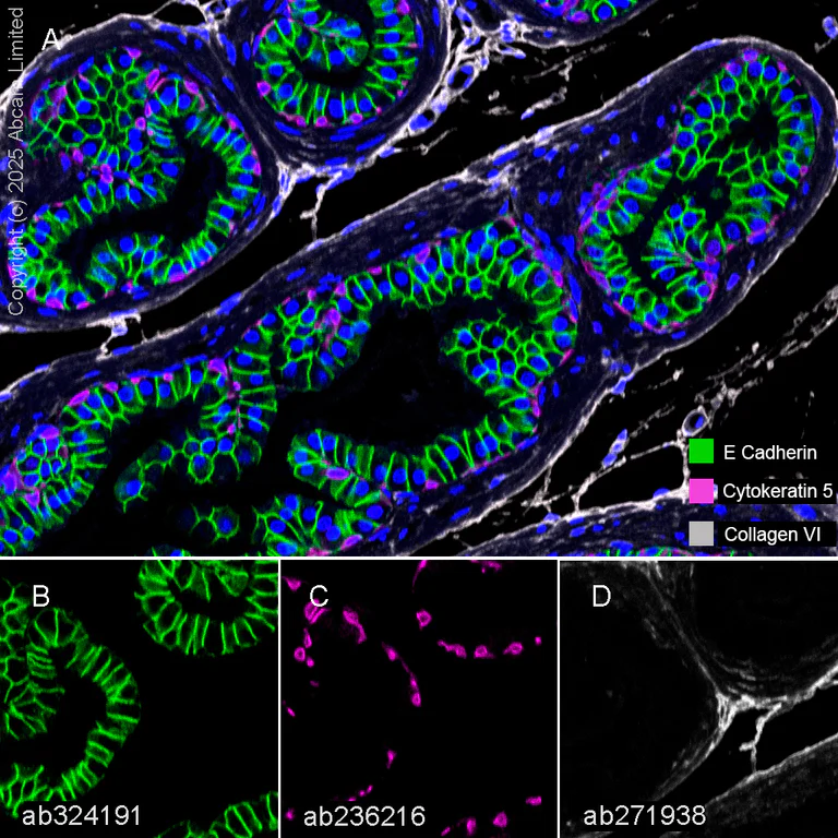 Multiplex immunohistochemistry - Anti-Collagen VI antibody [EPR17072] - BSA and Azide free (AB271938)