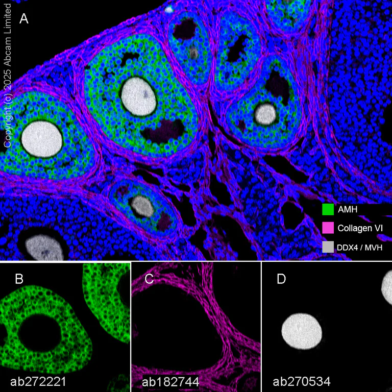 Multiplex immunohistochemistry - Anti-Collagen VI antibody [EPR17072] - BSA and Azide free (AB271938)