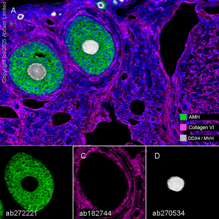 Multiplex immunohistochemistry - Anti-Collagen VI antibody [EPR17072] - BSA and Azide free (AB271938)