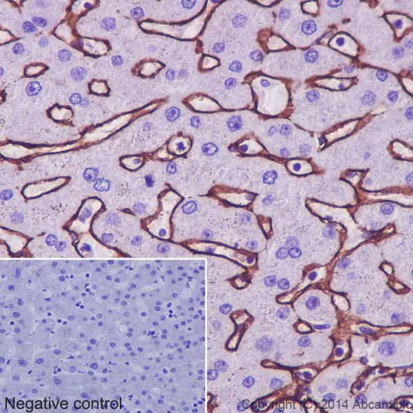 Immunohistochemistry (Formalin/PFA-fixed paraffin-embedded sections) - Anti-Collagen VI antibody [EPR17072] - Low endotoxin, Azide free (AB229450)