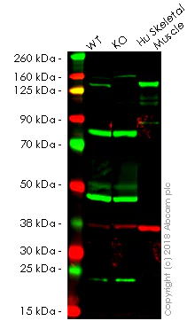 Western blot - Anti-Collagen VI antibody [EPR17072] - Low endotoxin, Azide free (AB229450)