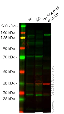 Western blot - Anti-Collagen VI antibody [EPR17077] - BSA and Azide free (AB240350)