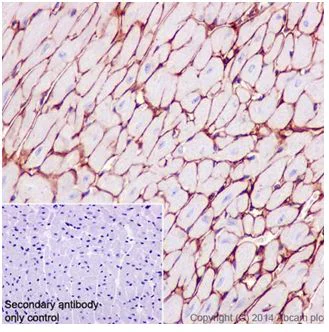 Immunohistochemistry (Formalin/PFA-fixed paraffin-embedded sections) - Anti-Collagen VI antibody [EPR17077] - C-terminal (AB199720)